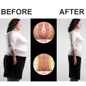 Ceinture Réglable Gilet Minceur Serre-Taille Corset Amincissante Abdominale 2