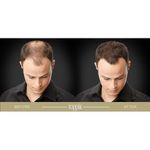 product_image_name-Toppik-Toppik Fibre De Cheveux Unisexe - 27.5g - Marron Foncé-2