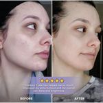 product_image_name-Générique-ICE cube glaçons visage et corps illuminer la peau et améliorer votre visage naturelle-orange-4