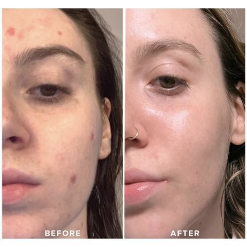 product_image_name-Générique-ICE cube glaçons visage et corps illuminer la peau et améliorer votre visage naturelle-orange-3