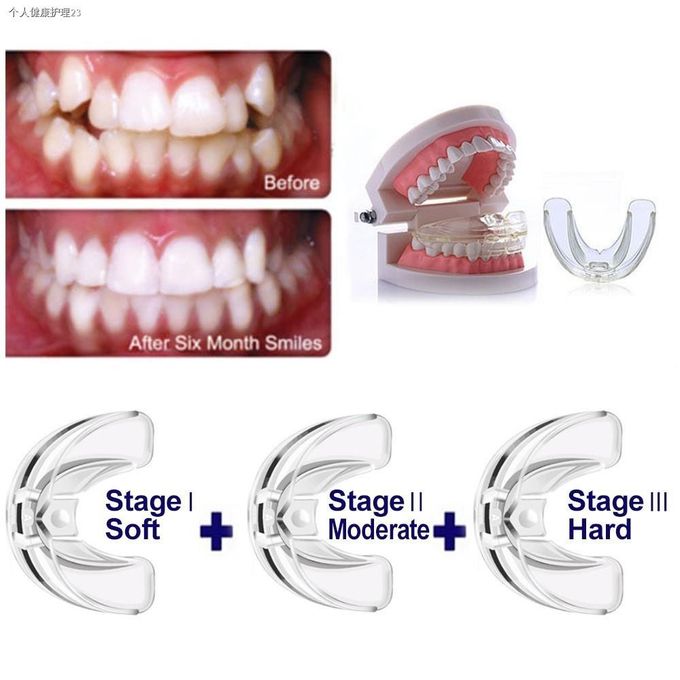  Aligneurs de dents pour redresser les dents, appareils orthodontiques dentaires