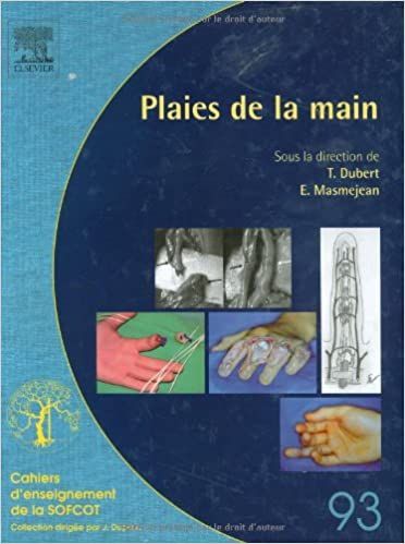  Publisher Plaies De La Main N° 93  C8 Med.