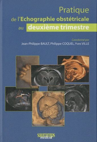  l'Etudiant Pratique De L'Échographie Obstétricale Au Deuxième Trimestre C18 Med.